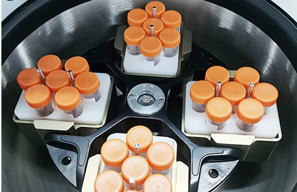 Come scegliere il tubo della centrifuga