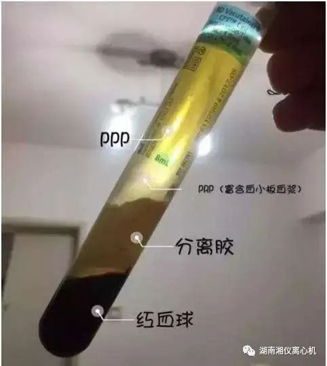 La missione di lancio del modulo centrale di Tianhe che trasporta la centrifuga spaziale di Xiangyi ha avuto successo!